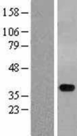 Novus Biologicals&trade;&nbsp;STYXL1 Overexpression Lysate