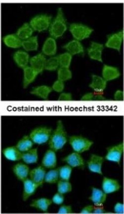 SUCLA2 Antibody, Novus Biologicals 0.1mg; Unlabeled:Antibodies, Polyclonal