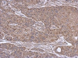 SUCLA2 Antibody, Novus Biologicals 0.1mg; Unlabeled:Antibodies, Polyclonal