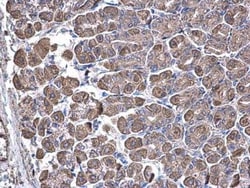 SUCLA2 Antibody, Novus Biologicals 0.1mg; Unlabeled:Antibodies, Polyclonal