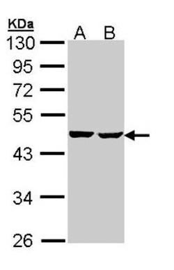 SUCLA2 Antibody, Novus Biologicals 0.1mg; Unlabeled:Antibodies, Polyclonal