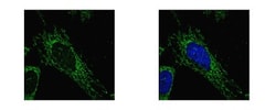 SUCLG1 Antibody, Novus Biologicals 0.1mg; Unlabeled:Antibodies, Polyclonal