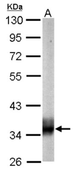 SUCLG1 Antibody, Novus Biologicals 0.1mg; Unlabeled:Antibodies, Polyclonal
