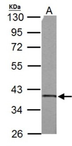 SUCLG1 Antibody, Novus Biologicals 0.1mg; Unlabeled:Antibodies, Polyclonal