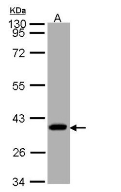 SUCLG1 Antibody, Novus Biologicals 0.1mg; Unlabeled:Antibodies, Polyclonal