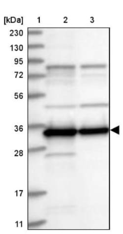 SUCLG1 Antibody, Novus Biologicals 25 &mu;L; Unlabeled:Antibodies, Polyclonal