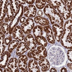 SUCLG2 Antibody, Novus Biologicals 25 &mu;L; Unlabeled:Antibodies, Polyclonal
