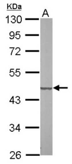 SUCLG2 Antibody, Novus Biologicals 0.1mL; Unlabeled:Antibodies, Polyclonal