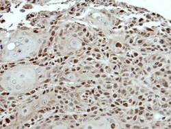 SUG1 Antibody, Novus Biologicals 0.1mL; Unlabeled:Antibodies, Polyclonal