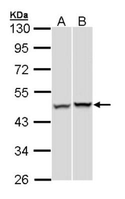 SUG1 Antibody, Novus Biologicals 100 &mu;L | Buy Online | Novus Biologicals | Fisher Scientific