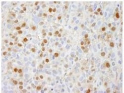 SUG1 Antibody, Novus Biologicals 0.1mL; Unlabeled:Antibodies, Polyclonal