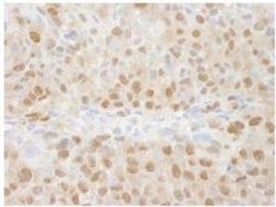SUG1 Antibody, Novus Biologicals 0.1mL; Unlabeled:Antibodies, Polyclonal