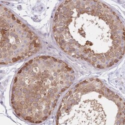 SUGT1 Antibody, Novus Biologicals 0.1mL; Unlabeled:Antibodies, Polyclonal
