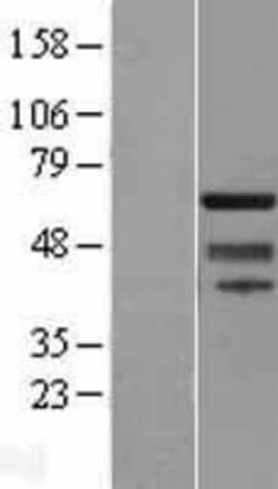 Novus Biologicals™ SUHW1 Overexpression Lysate