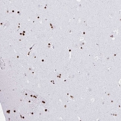 SUHW3 Antibody, Novus Biologicals 0.1mL; Unlabeled:Antibodies, Polyclonal