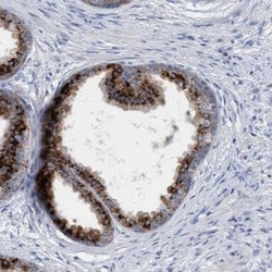 Sulfamidase/SGSH Antibody, Novus Biologicals 25 &mu;L; Unlabeled:Antibodies,