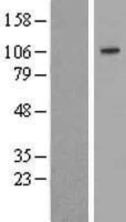 Novus Biologicals&trade;&nbsp;Sulfatase-2/SULF2 Overexpression Lysate