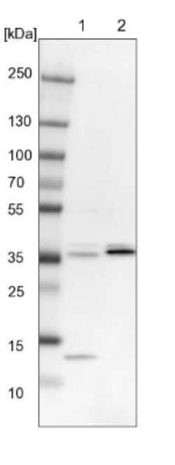Sulfatase Modifying Factor 1/SUMF1 Antibody, Novus Biologicals 25 &mu;L;