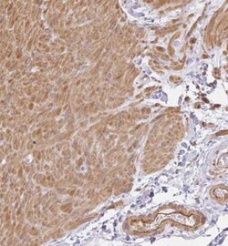 Sulfatase 1 Antibody, Novus Biologicals 0.1mL; Unlabeled:Antibodies, Polyclonal
