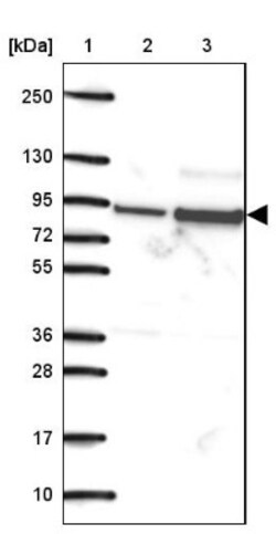 Sulfatase 1 Antibody, Novus Biologicals 0.1mL; Unlabeled:Antibodies, Polyclonal