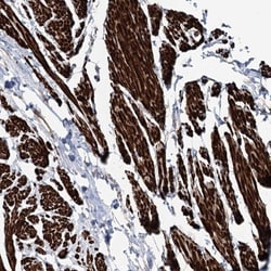 Sulfatase Modifying Factor 1/SUMF1 Antibody, Novus Biologicals 25 &mu;L;