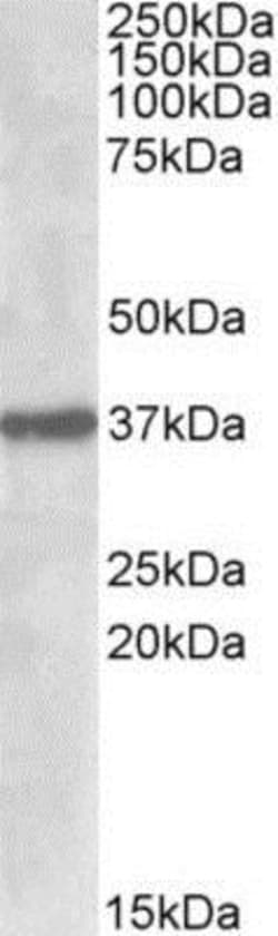 Sulfatase Modifying Factor 1/SUMF1 Antibody, Novus Biologicals 0.1mg; Unlabeled:Antibodies,