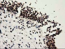 Cytosolic Sulfotransferase 1A1/SULT1A1 Antibody (OTI9B7), Novus Biologicals 0.1 mL | Buy Online | Novus Biologicals | Fisher Scientific