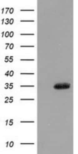 Cytosolic Sulfotransferase 1A1/SULT1A1 Antibody (OTI9B7), Novus Biologicals 0.1 mL | Buy Online | Novus Biologicals | Fisher Scientific