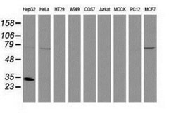 Cytosolic Sulfotransferase 1A1/SULT1A1 Antibody (OTI9B7), Novus Biologicals 0.1 mL | Buy Online | Novus Biologicals | Fisher Scientific