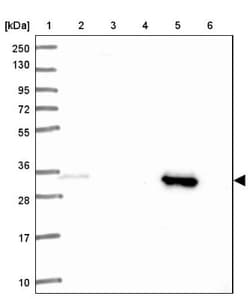 SULT1A2 Antibody, Novus Biologicals 0.1mL; Unlabeled:Antibodies, Polyclonal