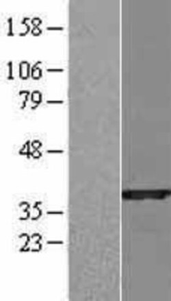 Novus Biologicals&trade;&nbsp;Cytosolic Sulfotransferase 1B1/SULT1B1 Overexpression Lysate