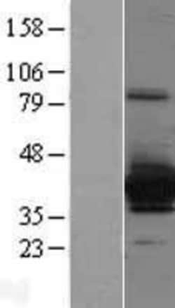 Novus Biologicals&trade;&nbsp;Cytosolic Sulfotransferase 4A1/SULT4A1 Overexpression Lysate
