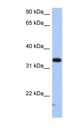 SULT6B1 Antibody, Novus Biologicals 100&mu;L; Unlabeled:Antibodies, Polyclonal
