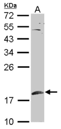 SUMO1 Antibody, Novus Biologicals 0.1mL; Unlabeled:Antibodies, Polyclonal
