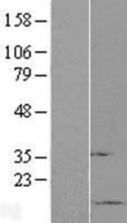 Novus Biologicals&trade;&nbsp;SUMO1 Overexpression Lysate