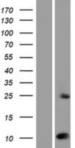 Novus Biologicals&trade;&nbsp;SUMO2 Overexpression Lysate