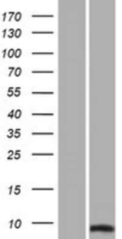 Novus Biologicals&trade;&nbsp;SUMO2 Overexpression Lysate