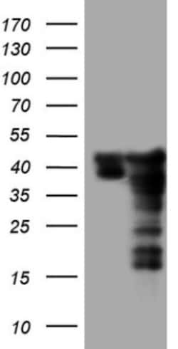 SUMO Activating Enzyme E1 (SAE1) Antibody (OTI6B11), Novus Biologicals 0.1 mL | Buy Online | Novus Biologicals | Fisher Scientific