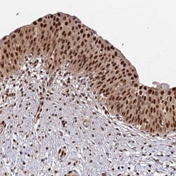 SUMO4 Antibody, Novus Biologicals 25 &mu;L | Buy Online | Novus Biologicals | Fisher Scientific
