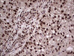 SUMO Activating Enzyme E1 (SAE1) Antibody (OTI6B11), Novus Biologicals 0.1 mL | Buy Online | Novus Biologicals | Fisher Scientific