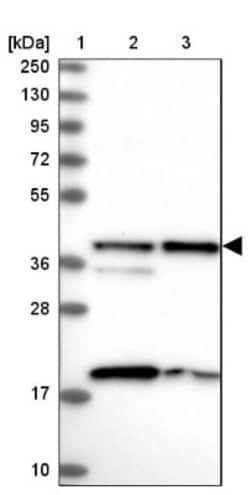 SUMO Activating Enzyme E1 (SAE1) Antibody, Novus Biologicals 0.1mL; Unlabeled:Antibodies,