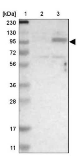 SUN1 Antibody, Novus Biologicals 0.1mL; Unlabeled:Antibodies, Polyclonal