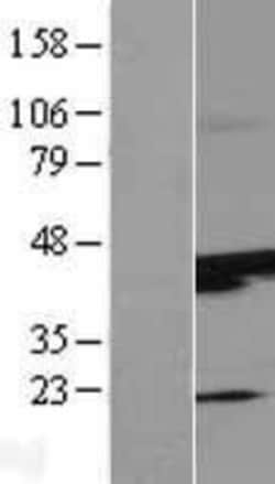 Novus Biologicals&trade;&nbsp;SUNC1 Overexpression Lysate