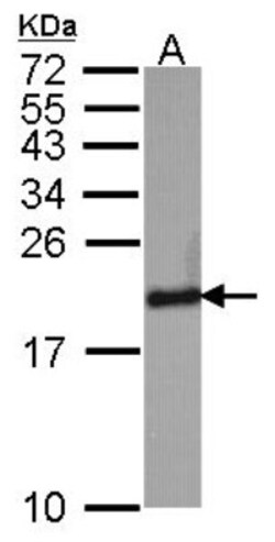 SOD1/Cu-Zn SOD Antibody, Novus Biologicals 0.1mL; Unlabeled:Antikroppar
