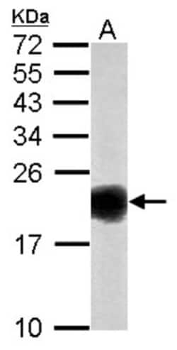 SOD1/Cu-Zn SOD Antibody, Novus Biologicals 0.1mL; Unlabeled:Antikroppar