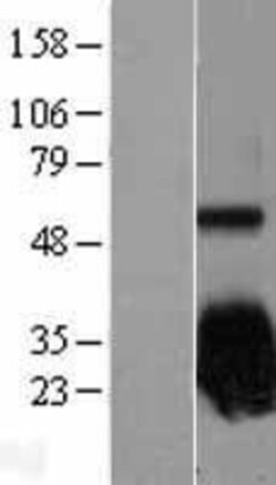 Novus Biologicals&trade;&nbsp;SOD2/Mn-SOD Overexpression Lysate