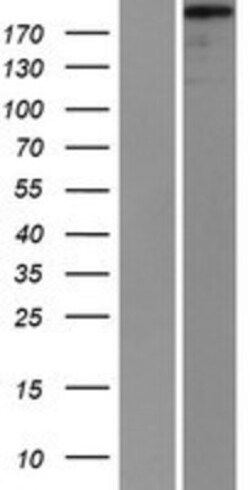 Novus Biologicals&trade;&nbsp;Supervillin Overexpression Lysate