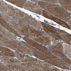 Supervillin Antibody, Novus Biologicals 0.1mL; Unlabeled:Antibodies, Polyclonal