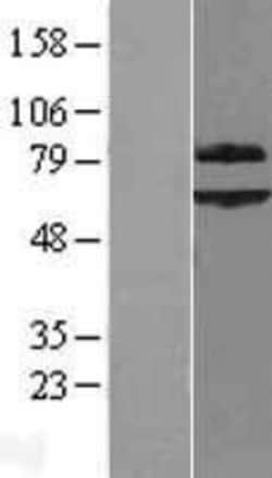 Novus Biologicals&trade;&nbsp;SUR-8 Overexpression Lysate