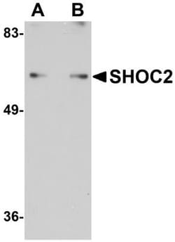 SUR-8 Antibody - BSA Free, Novus Biologicals 0.1mg; Unlabeled:Antibodies,